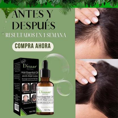 Kit Shampoo y Serum Anticaída DISAAR®