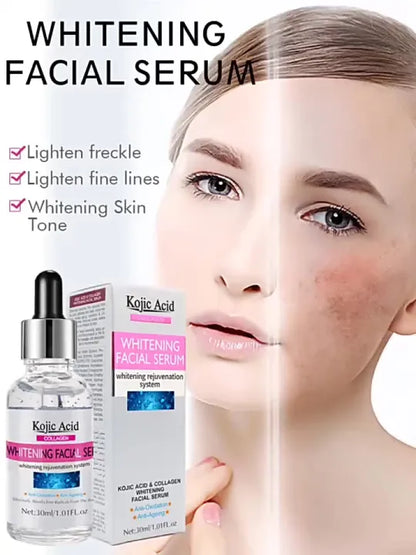 🧴🧪Serum Facial Aclarante Kojic Acid💧🌟