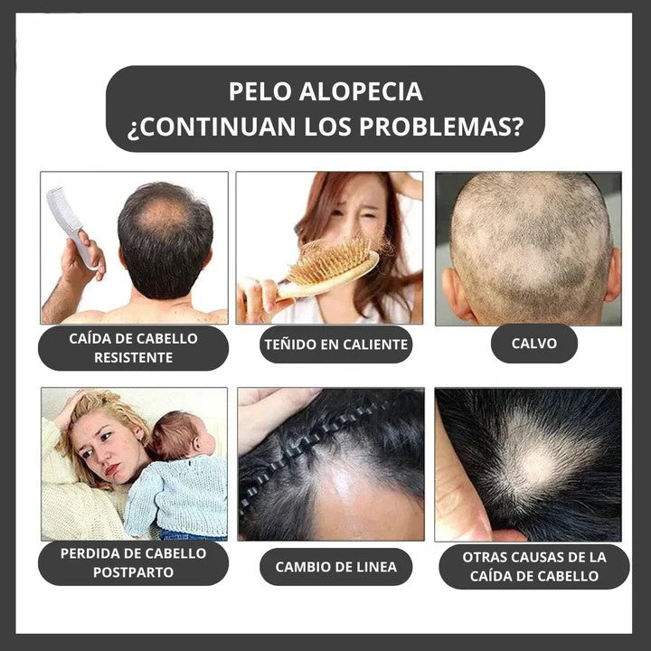 Kit Shampoo y Serum Anticaída DISAAR®