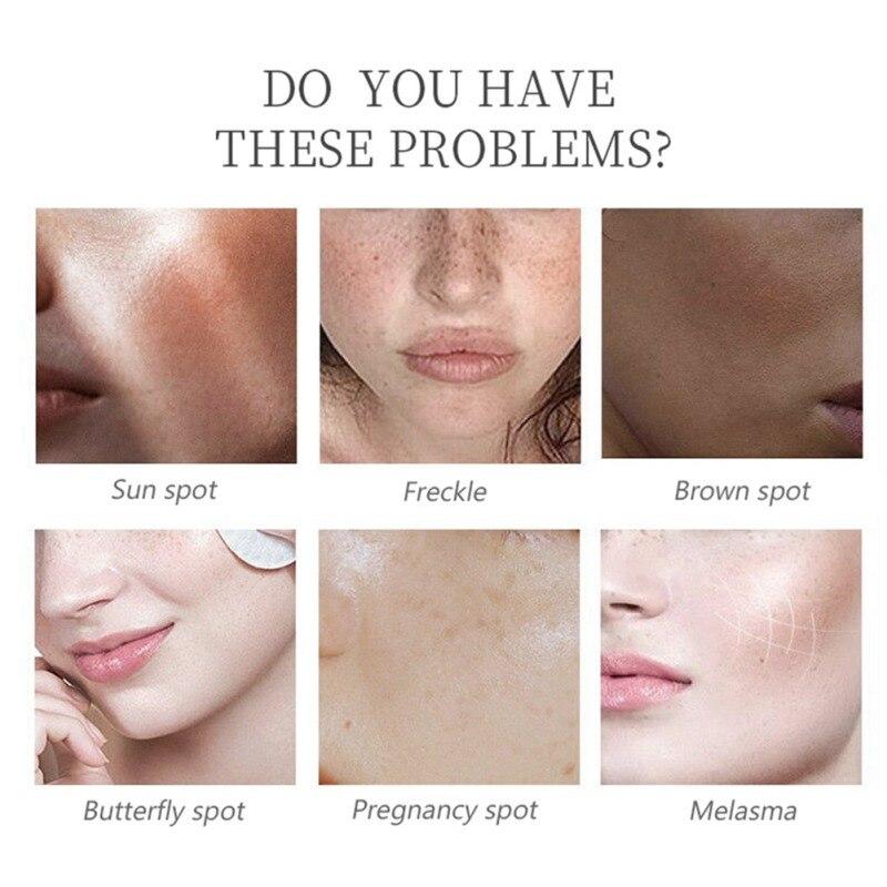 🧴🧪Serum Facial Aclarante Kojic Acid💧🌟