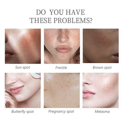 🧴🧪Serum Facial Aclarante Kojic Acid💧🌟