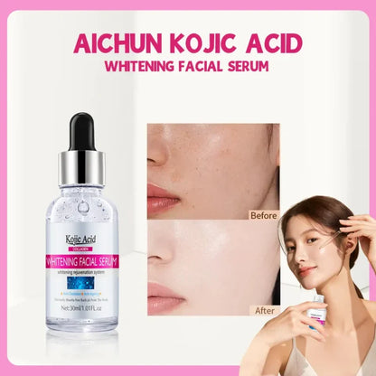 🧴🧪Serum Facial Aclarante Kojic Acid💧🌟